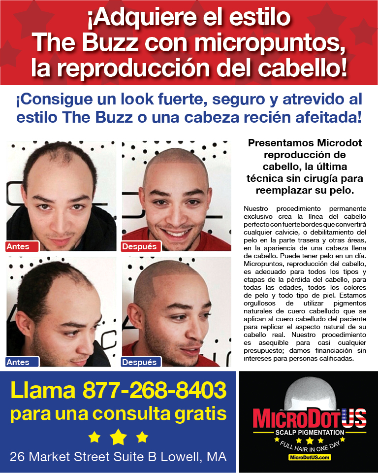 Scalp Pigmentation 4colx10%22 ESP